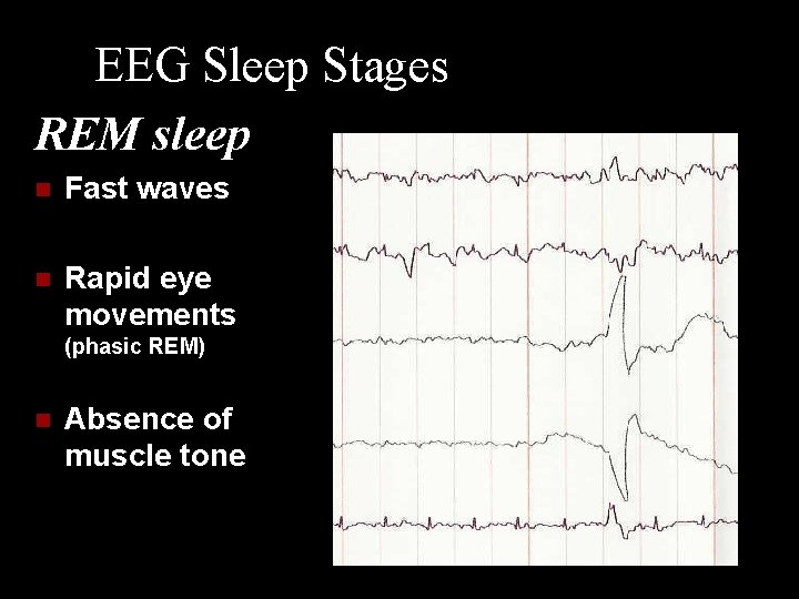 EEG Sleep Stages REM sleep n Fast waves n Rapid eye movements (phasic REM)