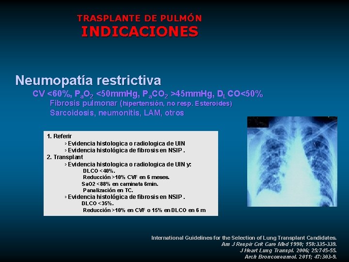 TRASPLANTE DE PULMÓN INDICACIONES Neumopatía restrictiva CV <60%, Pa. O 2 <50 mm. Hg,