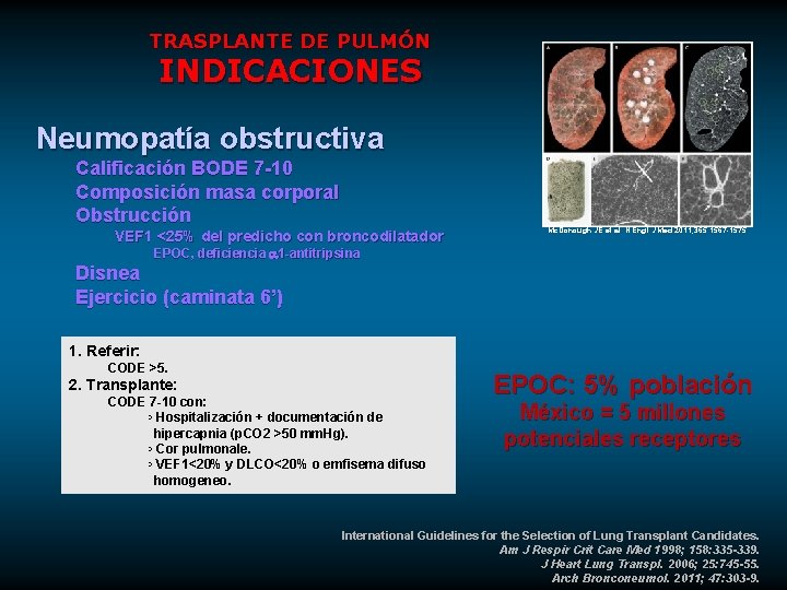 TRASPLANTE DE PULMÓN INDICACIONES Neumopatía obstructiva Calificación BODE 7 -10 Composición masa corporal Obstrucción