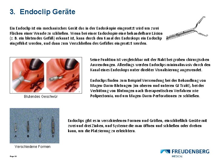 3. Endoclip Geräte Ein Endoclip ist ein mechanisches Gerät das in der Endoskopie eingesetzt