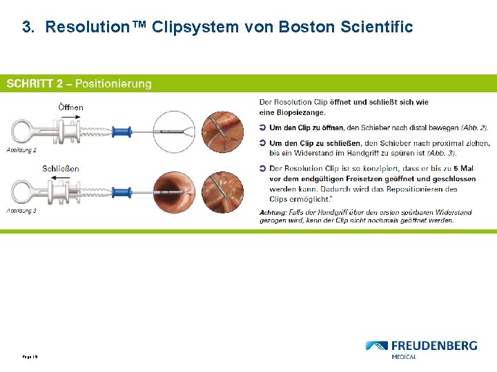 3. Resolution™ Clipsystem von Boston Scientific Page 15 