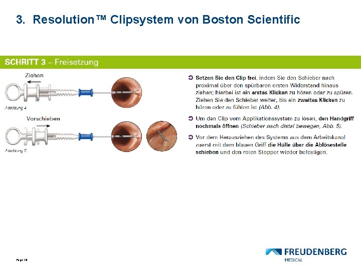 3. Resolution™ Clipsystem von Boston Scientific Page 16 
