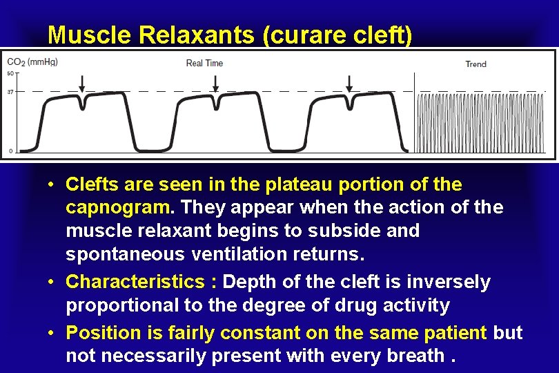 Muscle Relaxants (curare cleft) • Clefts are seen in the plateau portion of the