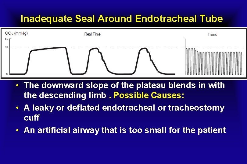 Inadequate Seal Around Endotracheal Tube • The downward slope of the plateau blends in