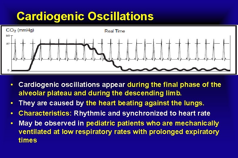 Cardiogenic Oscillations • Cardiogenic oscillations appear during the final phase of the alveolar plateau