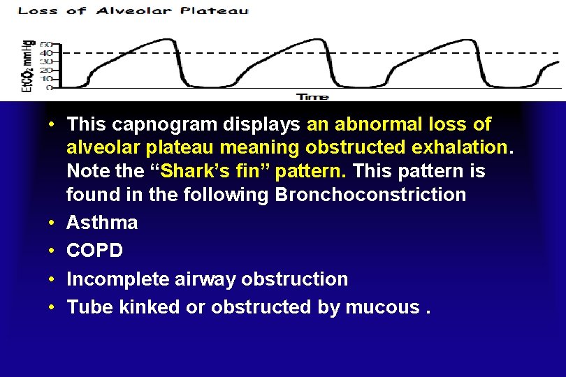  • This capnogram displays an abnormal loss of alveolar plateau meaning obstructed exhalation.