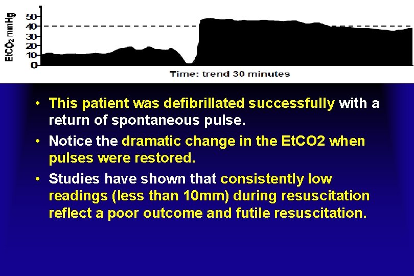  • This patient was defibrillated successfully with a return of spontaneous pulse. •