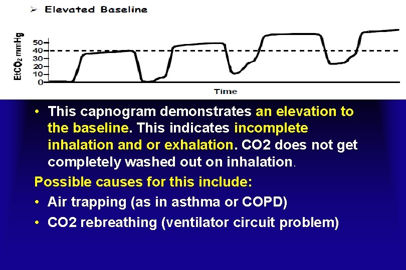  • This capnogram demonstrates an elevation to the baseline. This indicates incomplete inhalation