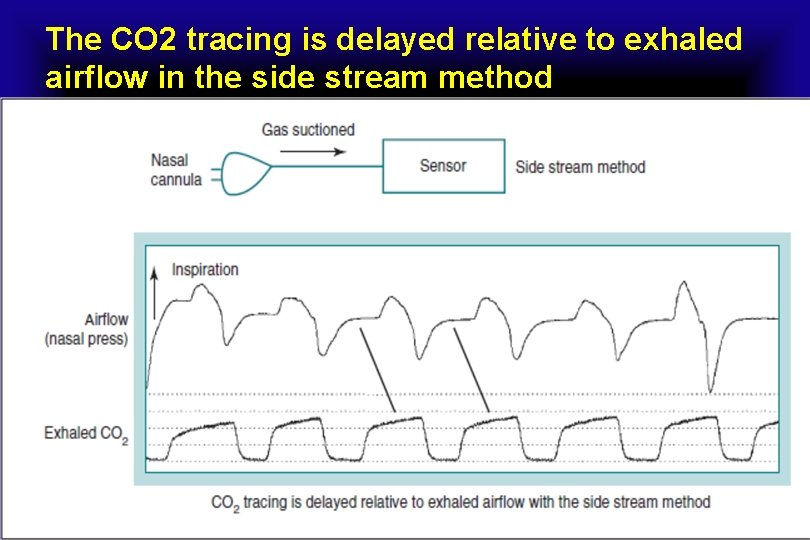 The CO 2 tracing is delayed relative to exhaled airflow in the side stream