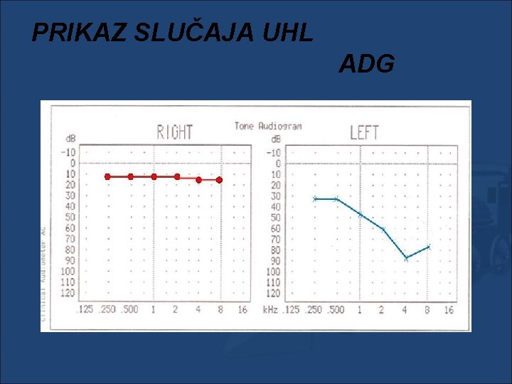 PRIKAZ SLUČAJA UHL ADG 