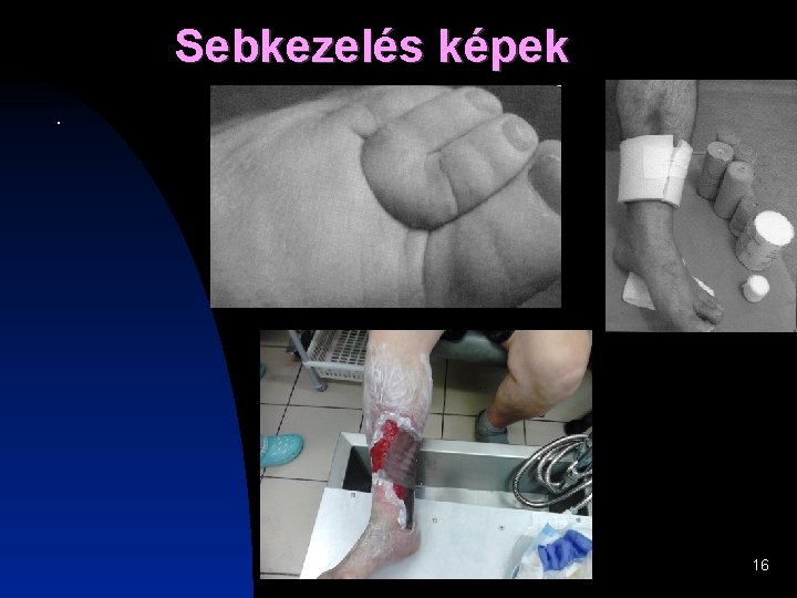Sebkezelés képek. 16 Sebkezelés képek. 16