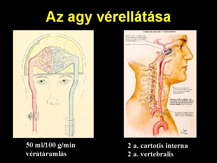 Az agy vérellátása 50 ml/100 g/min vérátáramlás 2 a. cartotis interna 2 a. vertebralis