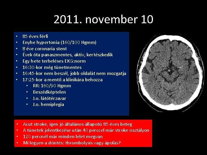2011. november 10 • • 85 éves férfi Enyhe hypertonia (160/100 Hgmm) 8 éve