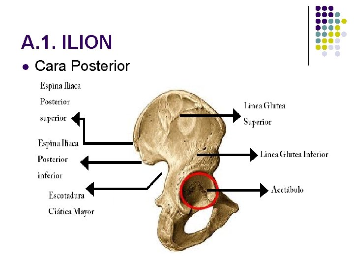 A. 1. ILION l Cara Posterior 