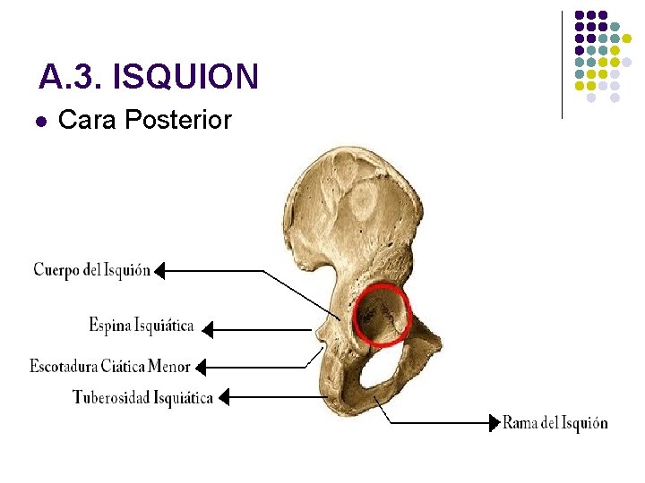 A. 3. ISQUION l Cara Posterior 