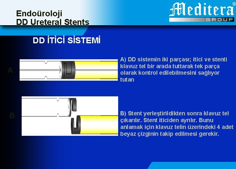 Endoüroloji DD Ureteral Stents DD İTİCİ SİSTEMİ A B A) DD sistemin iki parçası;