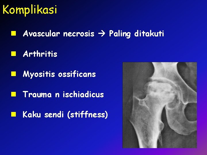 Komplikasi n Avascular necrosis Paling ditakuti n Arthritis n Myositis ossificans n Trauma n