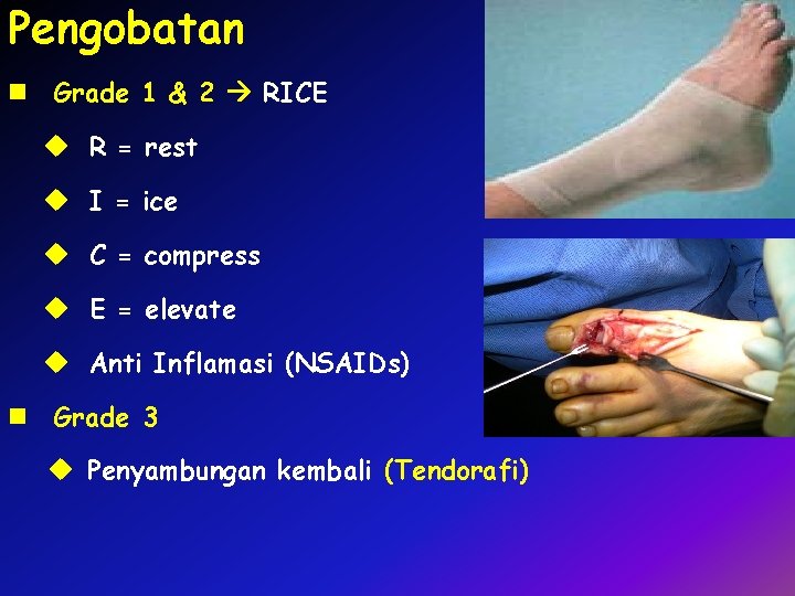 Pengobatan n Grade 1 & 2 RICE u R = rest u I =