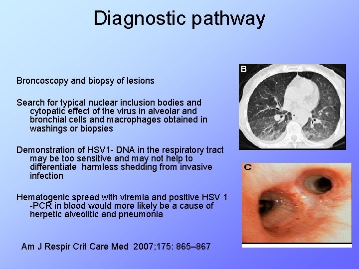 Diagnostic pathway Broncoscopy and biopsy of lesions Search for typical nuclear inclusion bodies and