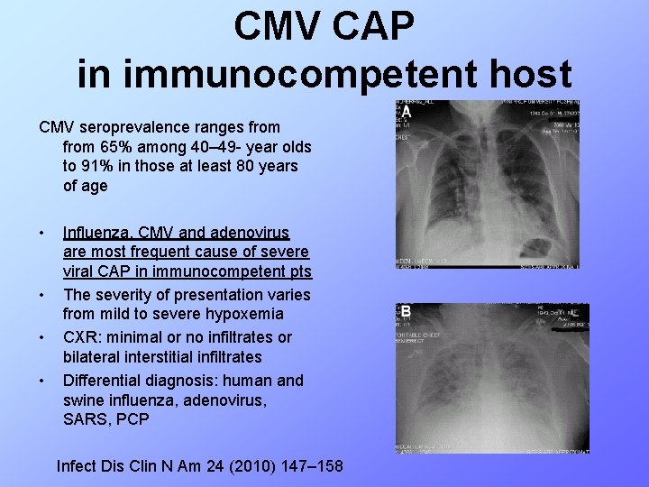 CMV CAP in immunocompetent host CMV seroprevalence ranges from 65% among 40– 49 -
