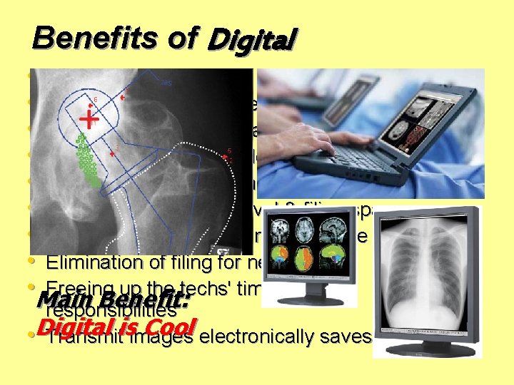 Benefits of Digital • Improved patient care • More time in direct patient care