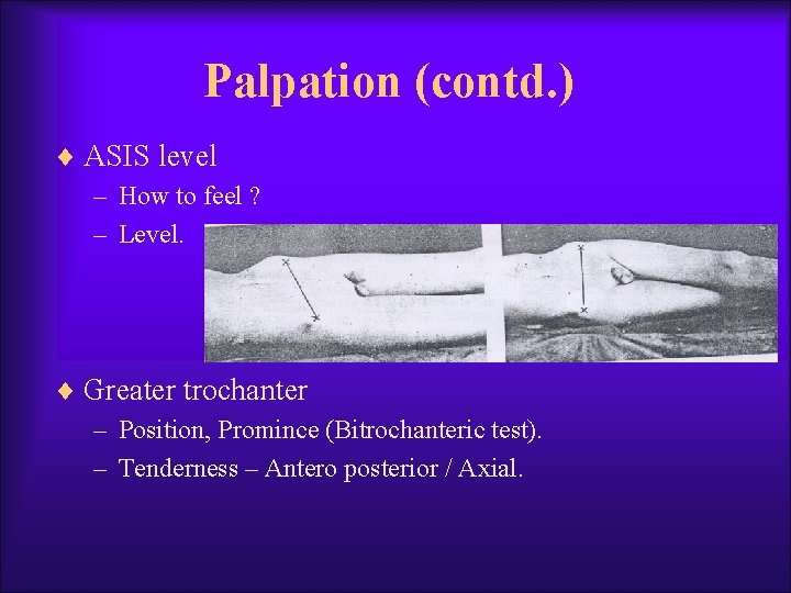 Palpation (contd. ) ¨ ASIS level – How to feel ? – Level. ¨