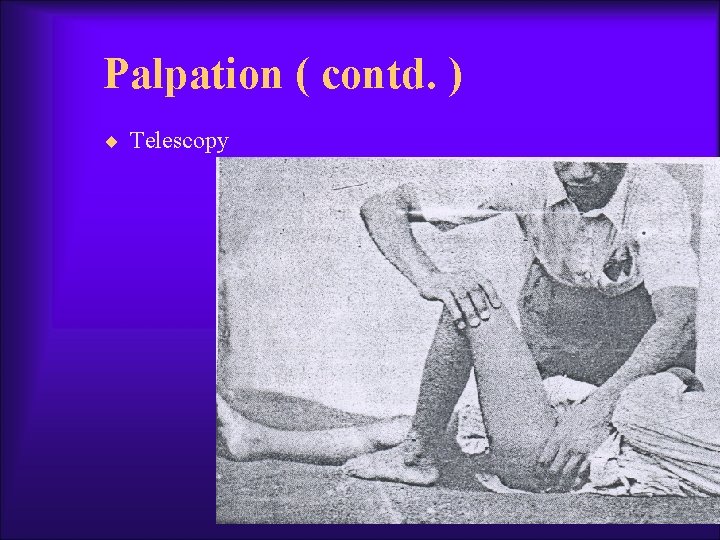 Palpation ( contd. ) ¨ Telescopy 