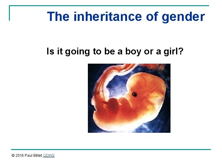 The inheritance of gender Is it going to be a boy or a girl?