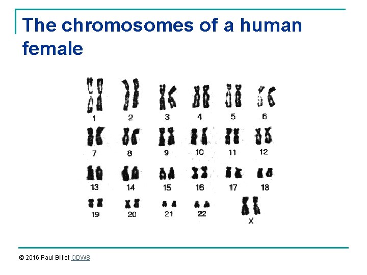 The chromosomes of a human female © 2016 Paul Billiet ODWS 