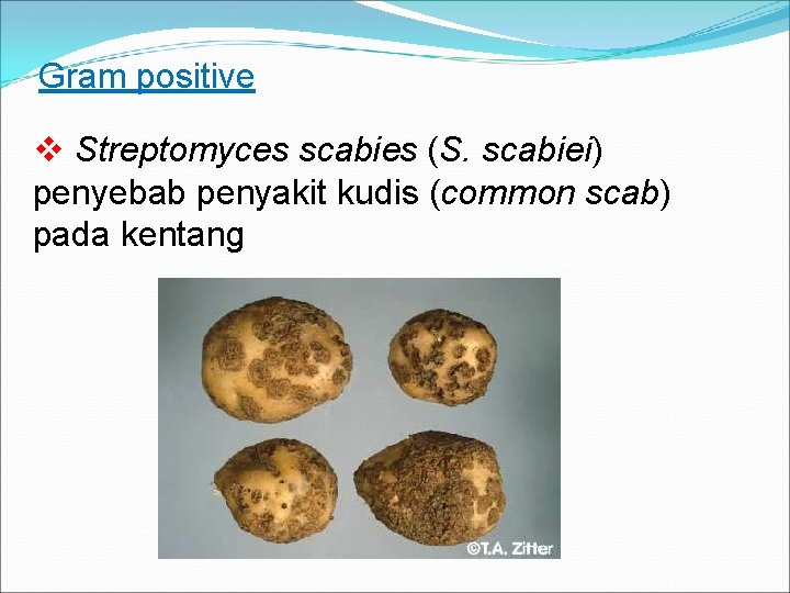 Gram positive v Streptomyces scabies (S. scabiei) penyebab penyakit kudis (common scab) pada kentang
