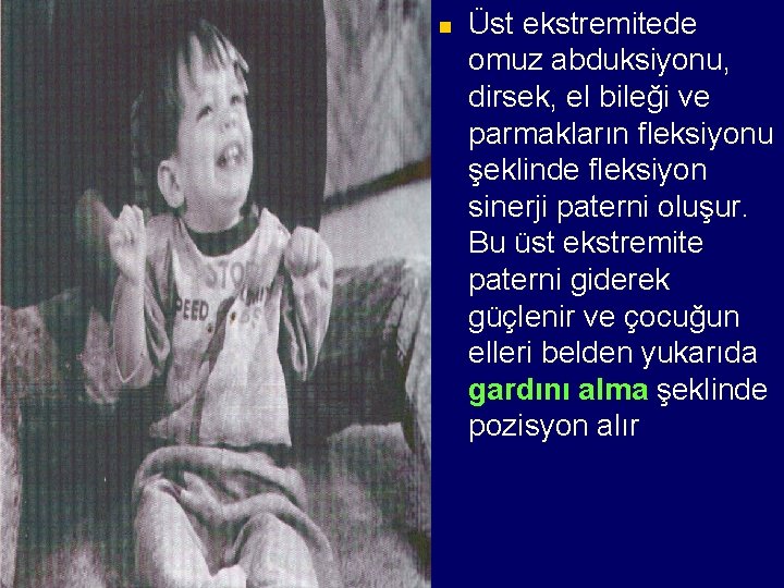 n Üst ekstremitede omuz abduksiyonu, dirsek, el bileği ve parmakların fleksiyonu şeklinde fleksiyon sinerji