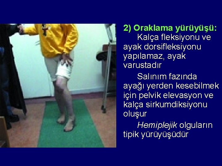 2) Oraklama yürüyüşü: Kalça fleksiyonu ve ayak dorsifleksiyonu yapılamaz, ayak varustadır Salınım fazında ayağı