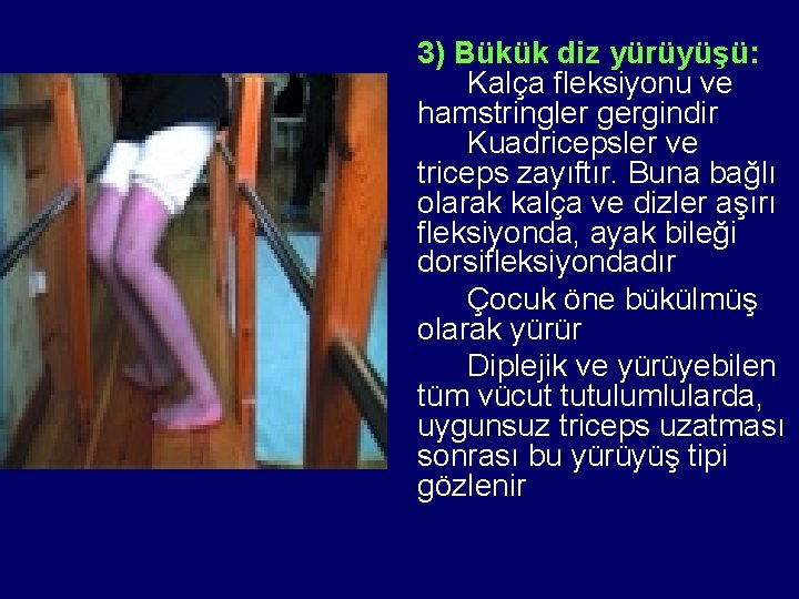 3) Bükük diz yürüyüşü: Kalça fleksiyonu ve hamstringler gergindir Kuadricepsler ve triceps zayıftır. Buna