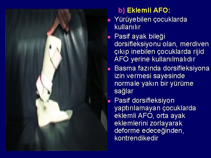 n n b) Eklemli AFO: Yürüyebilen çocuklarda kullanılır Pasif ayak bileği dorsifleksiyonu olan, merdiven