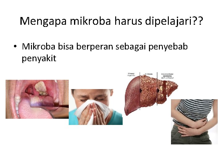 Mengapa mikroba harus dipelajari? ? • Mikroba bisa berperan sebagai penyebab penyakit 