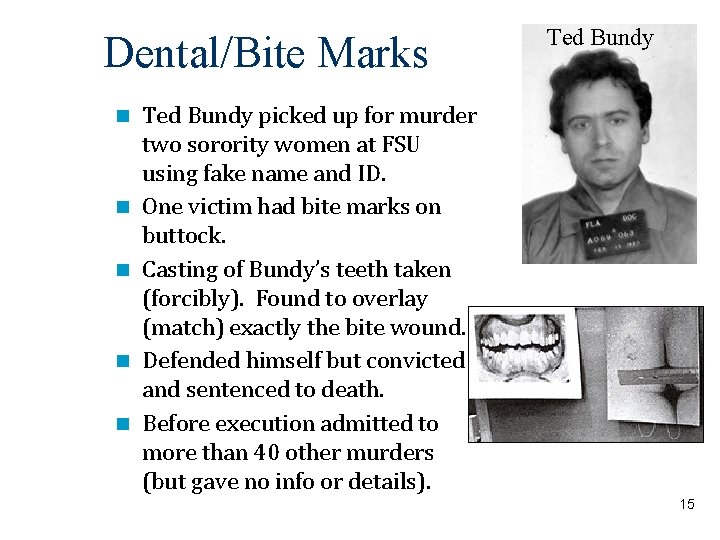 Dental/Bite Marks Ted Bundy picked up for murder two sorority women at FSU using
