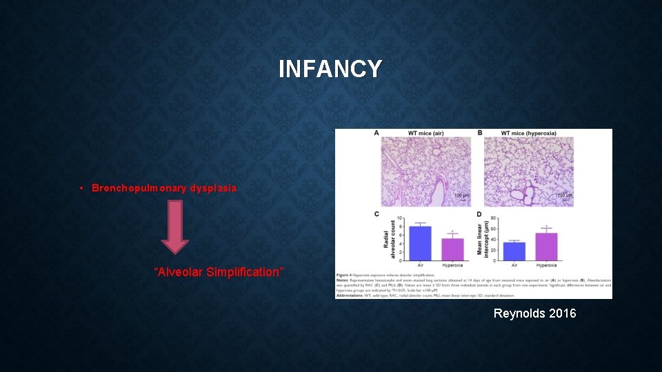 INFANCY • Bronchopulmonary dysplasia “Alveolar Simplification” Reynolds 2016 