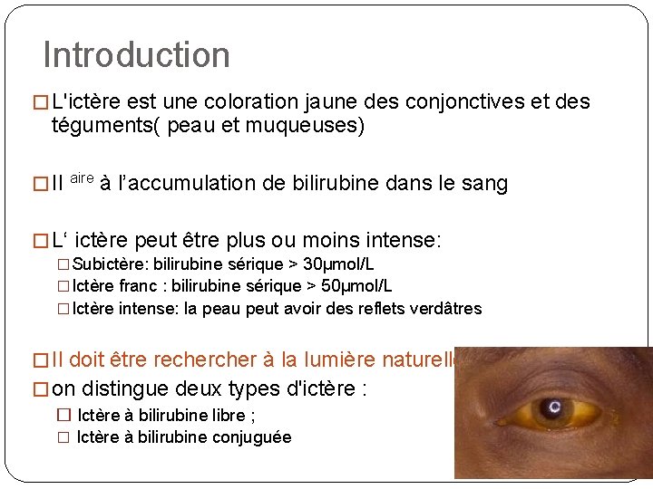 Introduction � L'ictère est une coloration jaune des conjonctives et des téguments( peau et