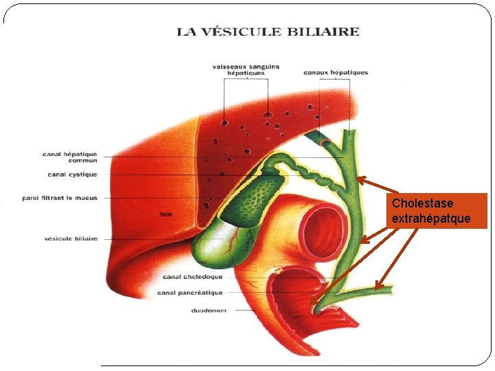 Rappel anatomique Cholestase extrahépatque 