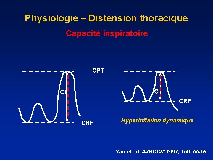 Physiologie – Distension thoracique Capacité inspiratoire CPT CI CI CRF Hyperinflation dynamique Yan et