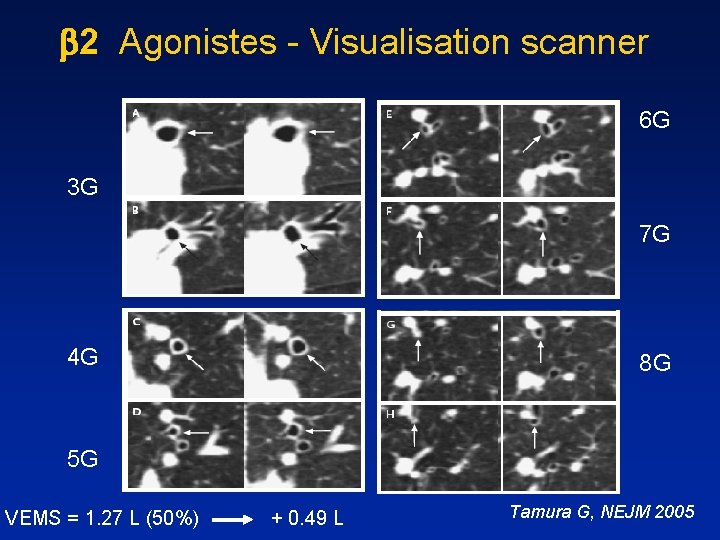  2 Agonistes - Visualisation scanner 6 G 3 G 7 G 4 G