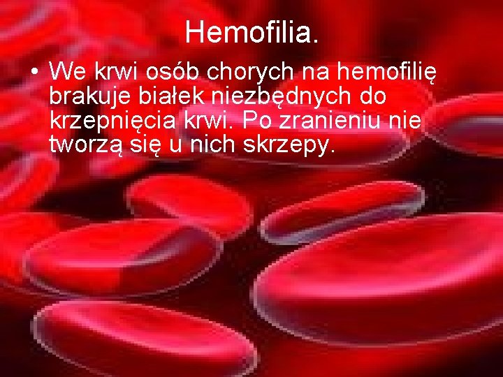 Hemofilia. • We krwi osób chorych na hemofilię brakuje białek niezbędnych do krzepnięcia krwi.