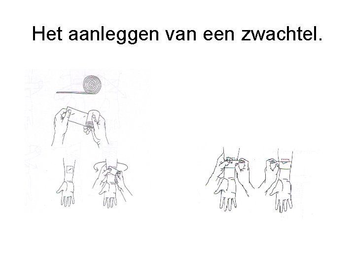 Het aanleggen van een zwachtel. 