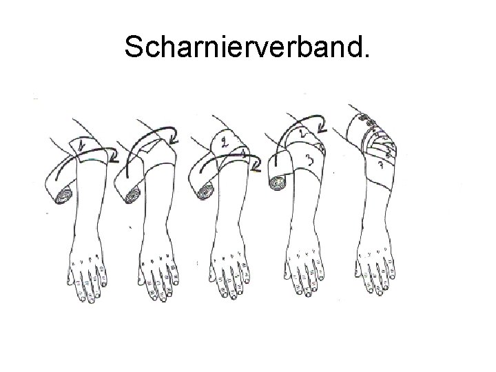 Scharnierverband. 