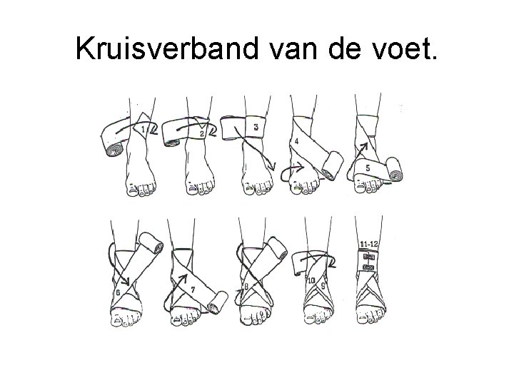 Kruisverband van de voet. 