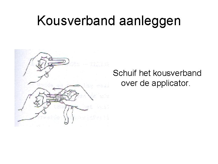 Kousverband aanleggen Schuif het kousverband over de applicator. 