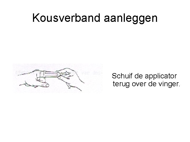 Kousverband aanleggen Schuif de applicator terug over de vinger. 