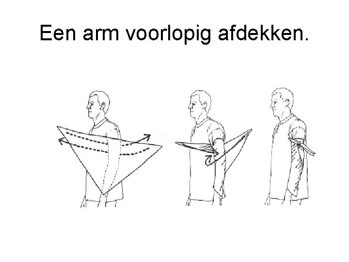 Een arm voorlopig afdekken. 