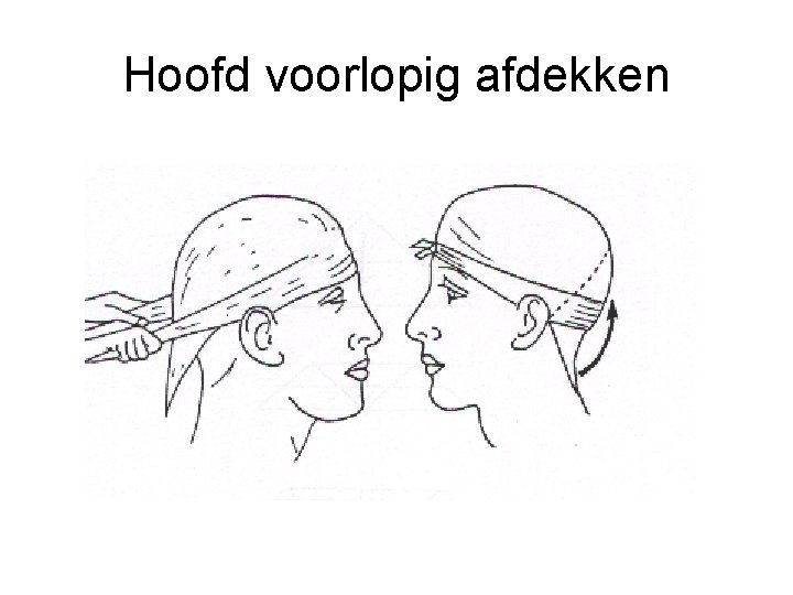 Hoofd voorlopig afdekken 