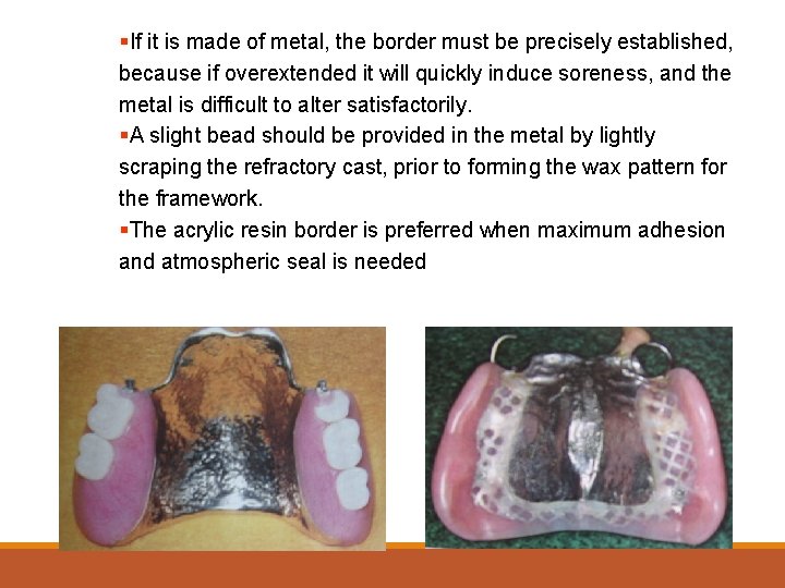 §If it is made of metal, the border must be precisely established, because if